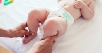 Рахіт та дефіцит вітаміну D